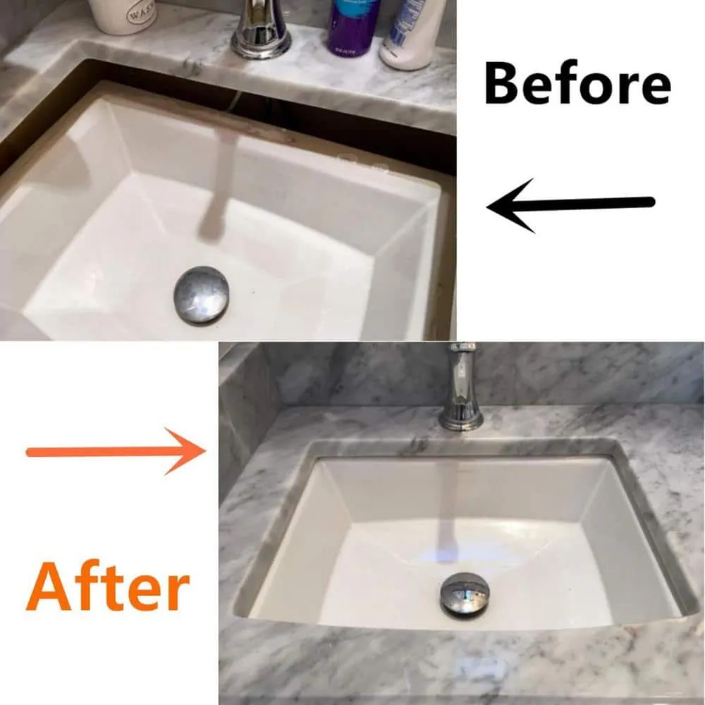 Numhew Undermount Sink Repair Kit with Adjustable Steel Brackets, photo 3 of 7